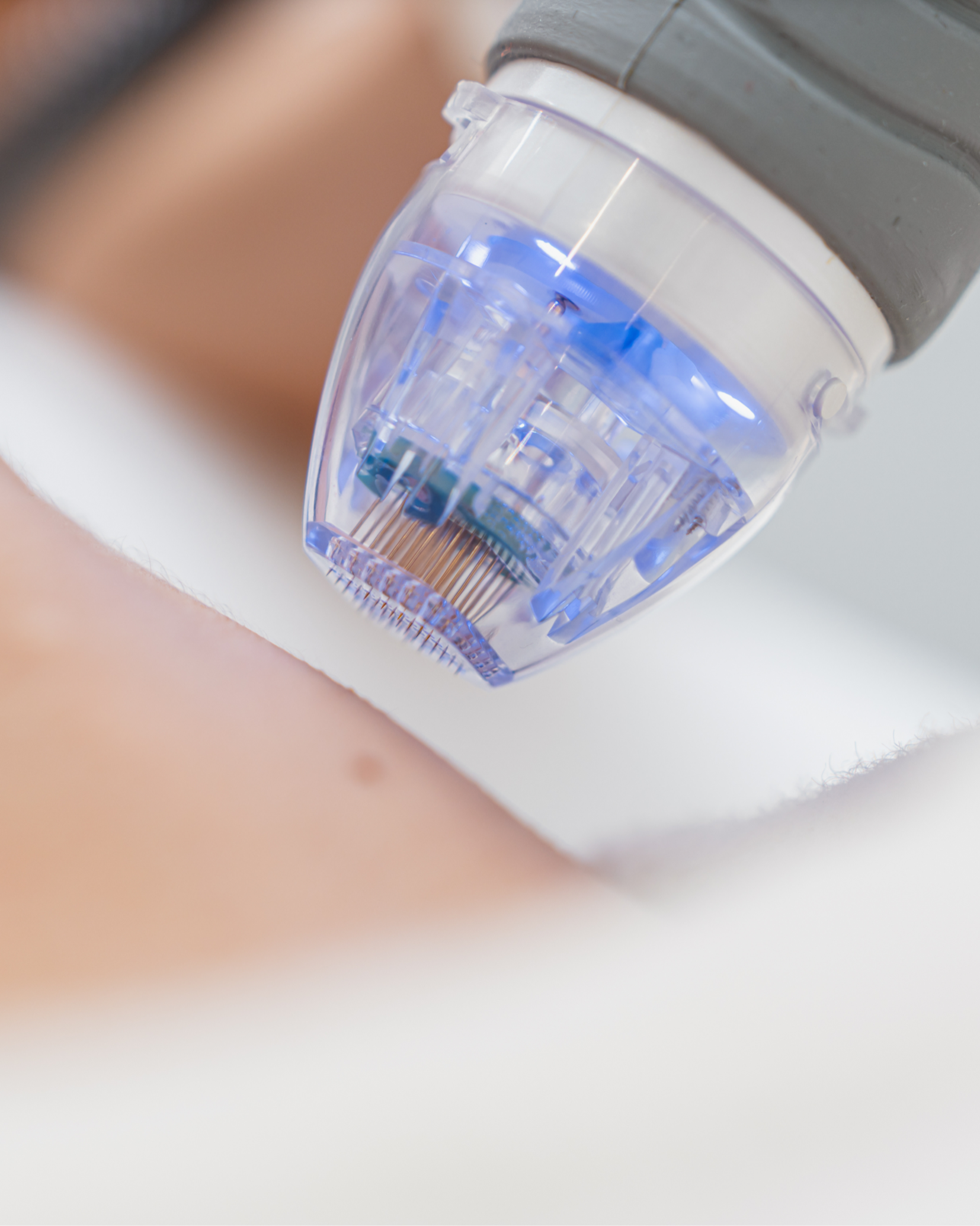 kosmetiske behandlinger for arr